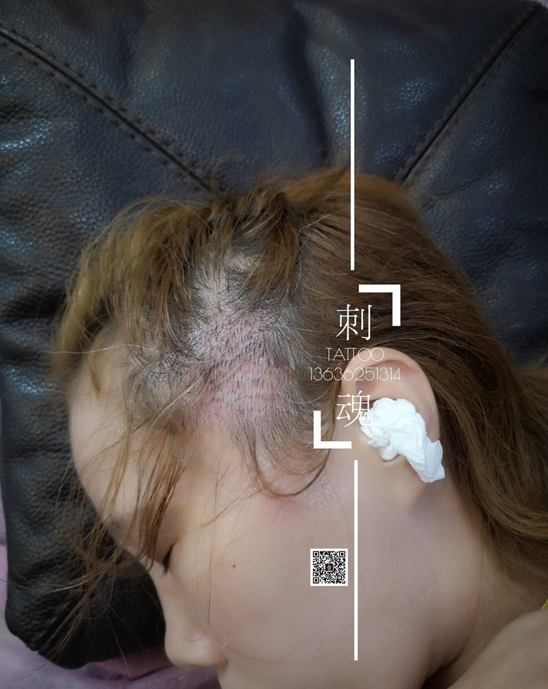 头皮补发纹身图片_点刺头部纹身图案