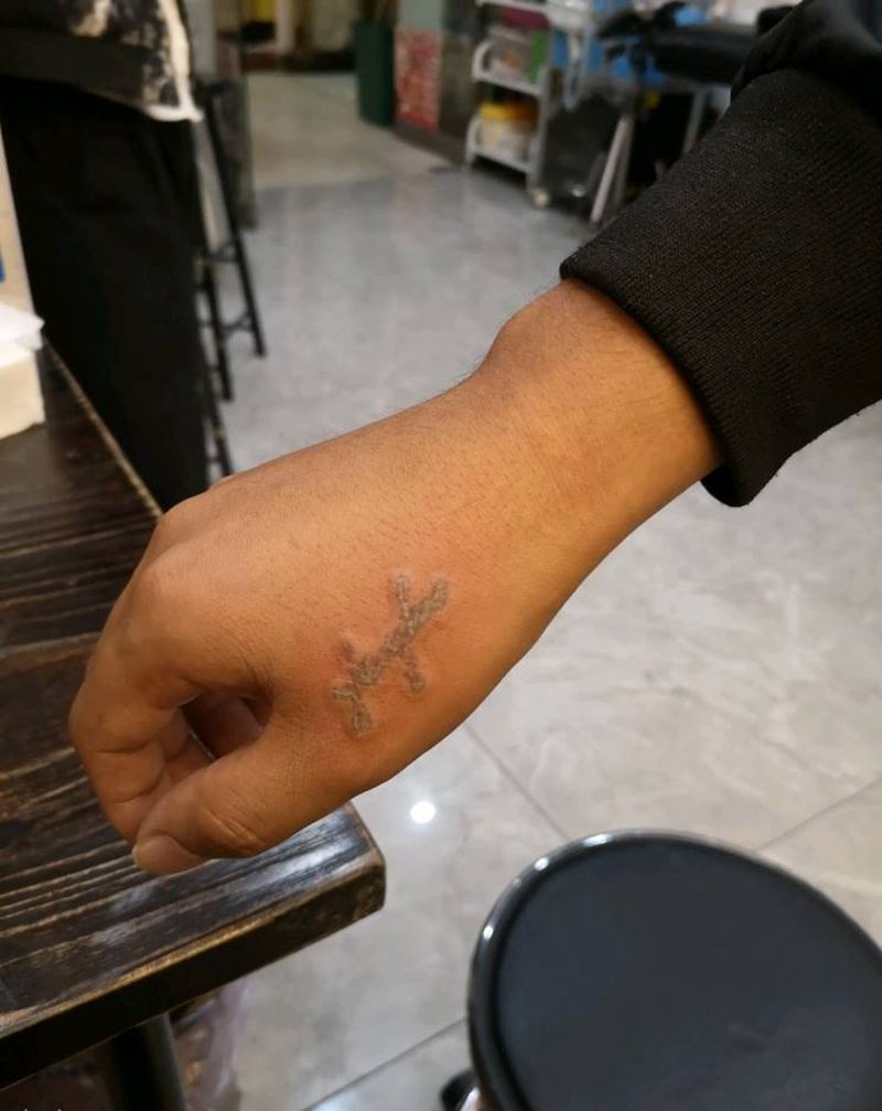 旧纹身祛除纹身图片_手臂图腾纹身图案