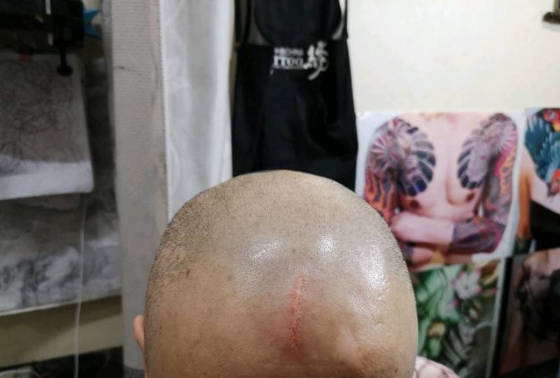 遮盖疤痕纹身图片