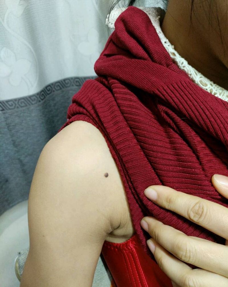 祛痣纹身图片_肩部背部传统原创花絮生活成品纹身图案