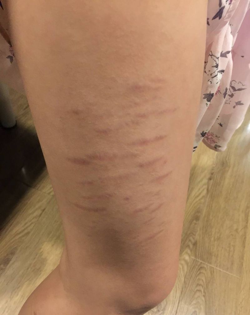 遮盖疤痕纹身图片