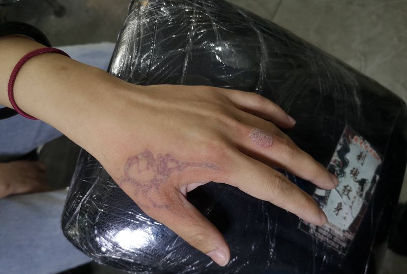 祛除旧纹身纹身图片_祛除旧纹身图案