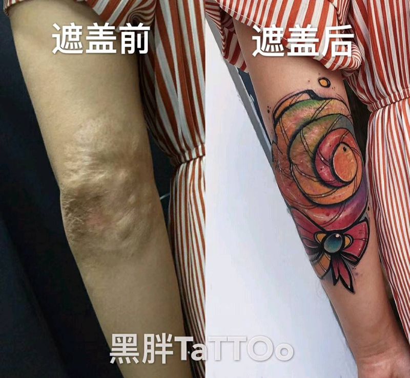 伤疤遮盖纹身图片