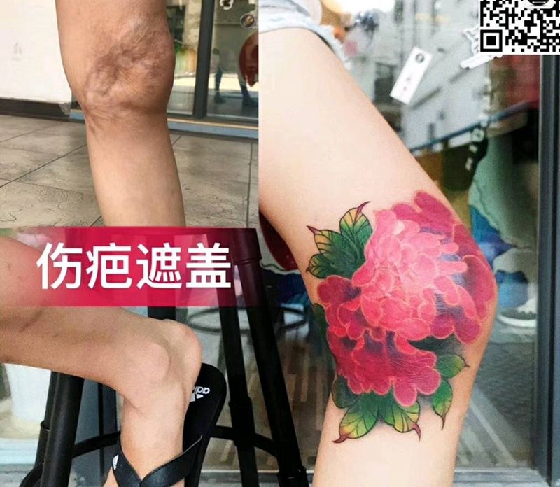 牡丹，疤痕遮盖纹身图片_腿部纹身图案