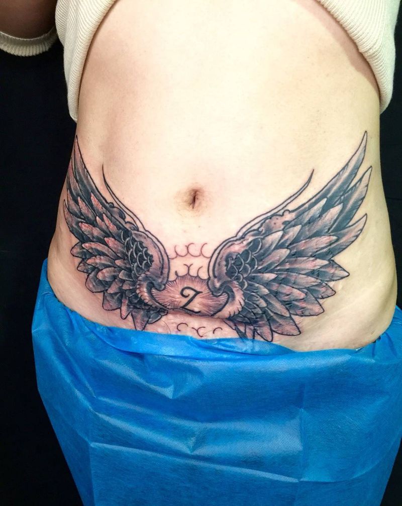 盖妊娠纹和疤痕，未完成，还需一次纹身图片