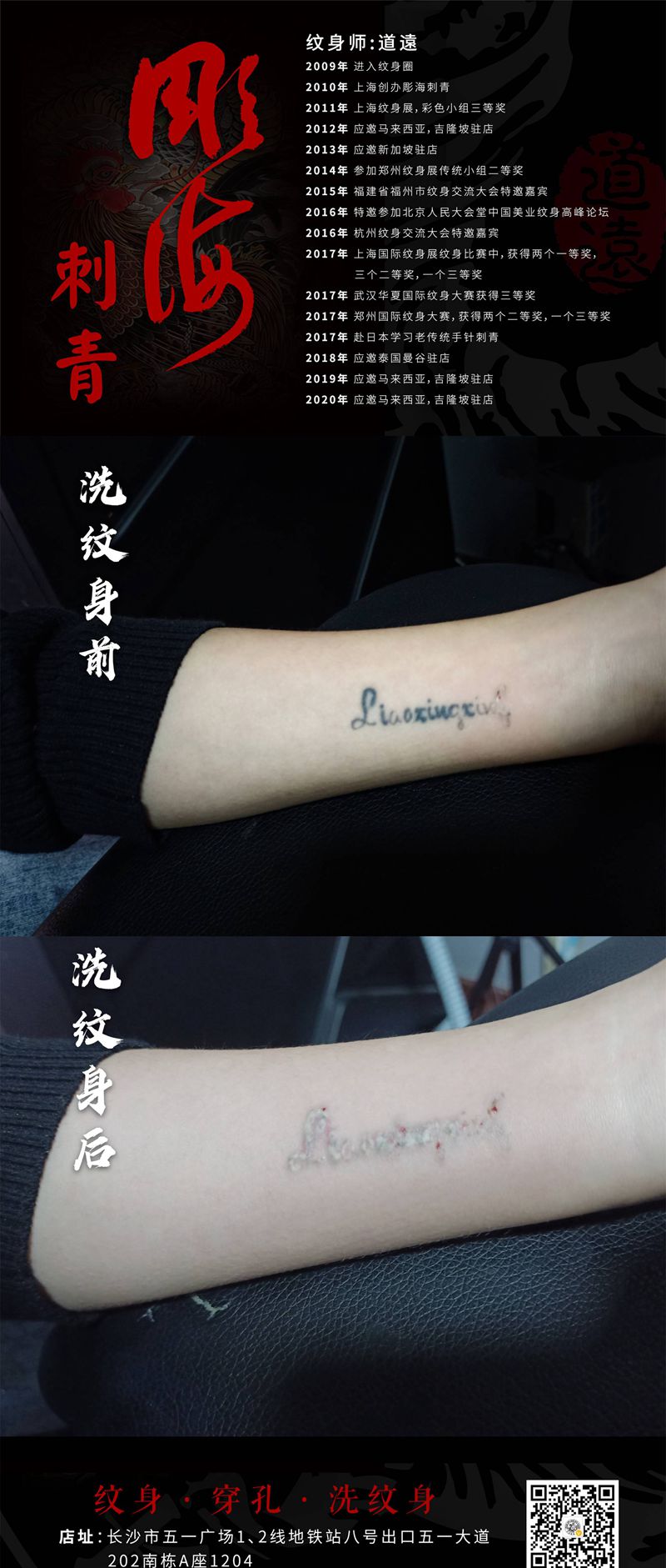 皮秒洗纹身纹身图片_手臂纹身图案