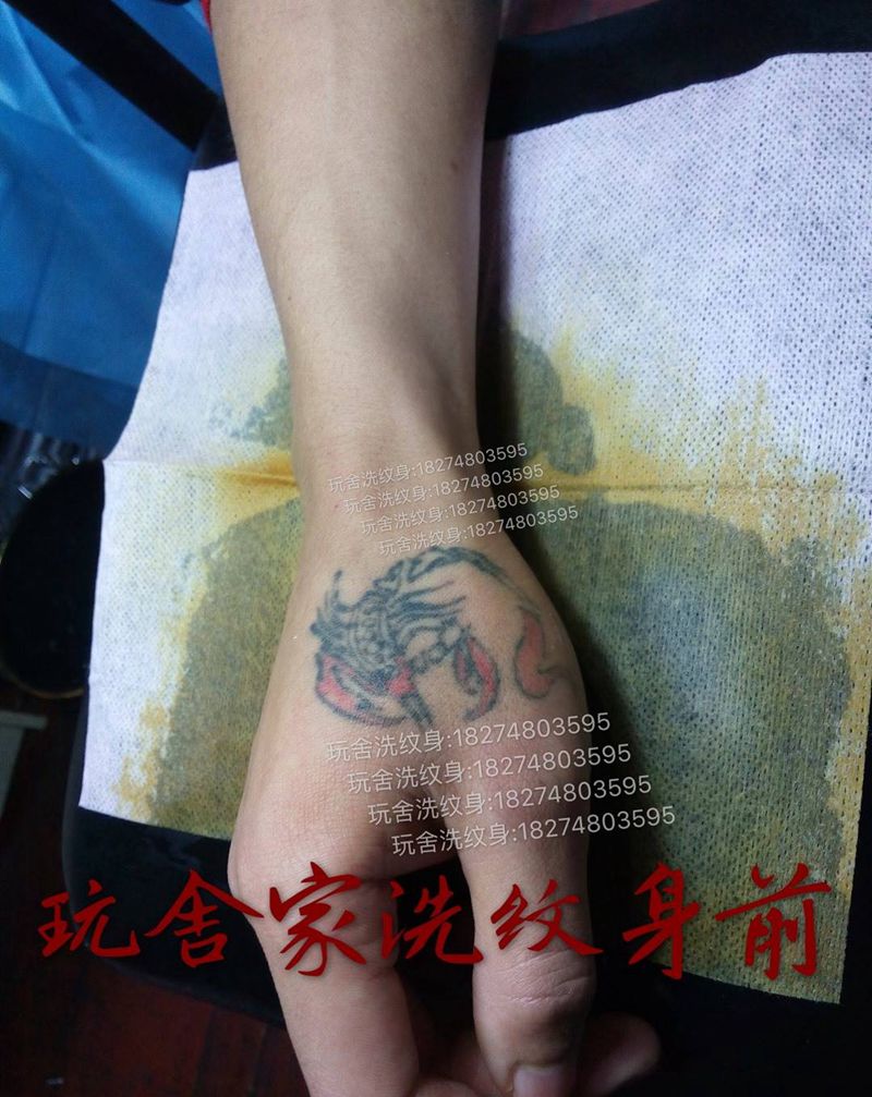 洗纹身案例纹身图片