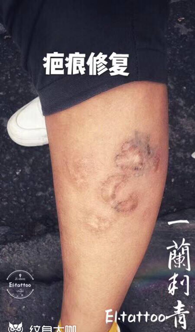 遮盖疤痕纹身图片_腿部纹身图案