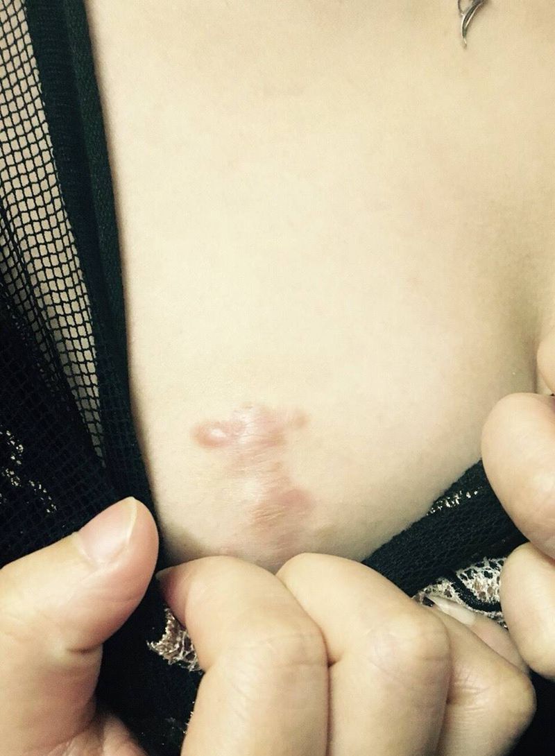 遮盖伤痕纹身图片