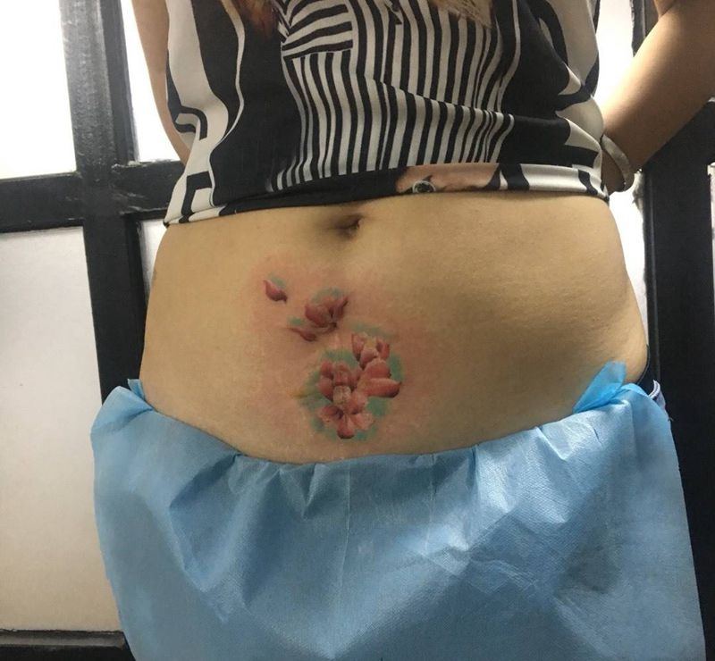 花,覆盖疤痕纹身图片