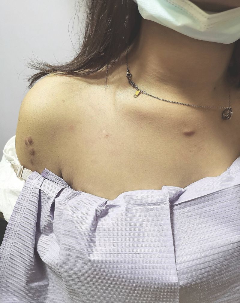 遮盖疤痕纹身图片_胸部新传统纹身图案