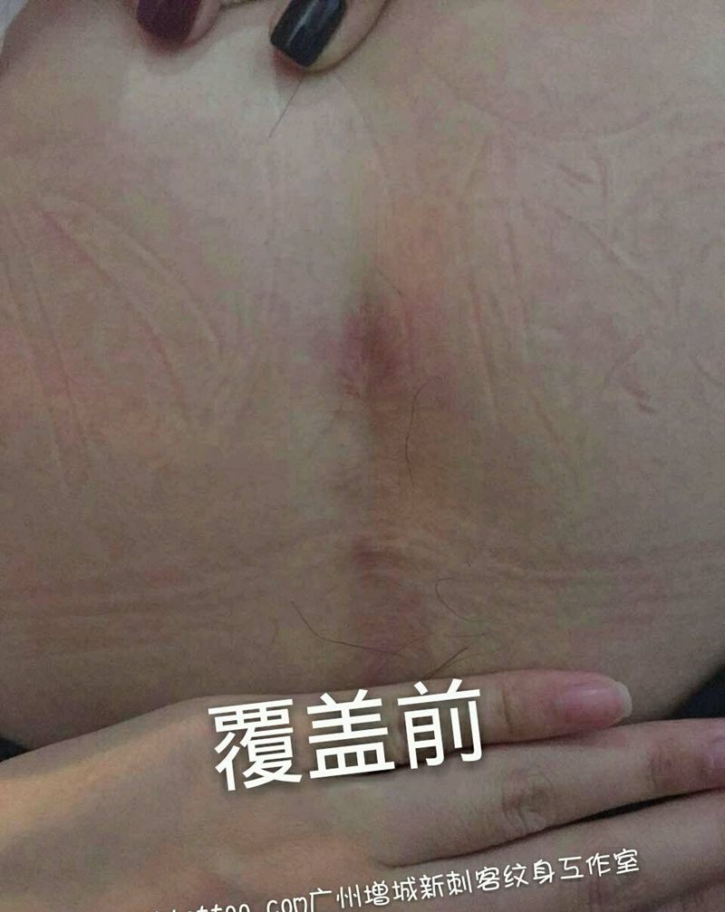 覆盖疤痕纹身图片