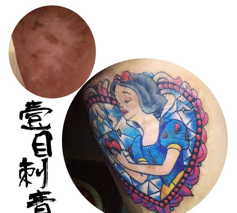 遮盖烫伤疤纹身图片