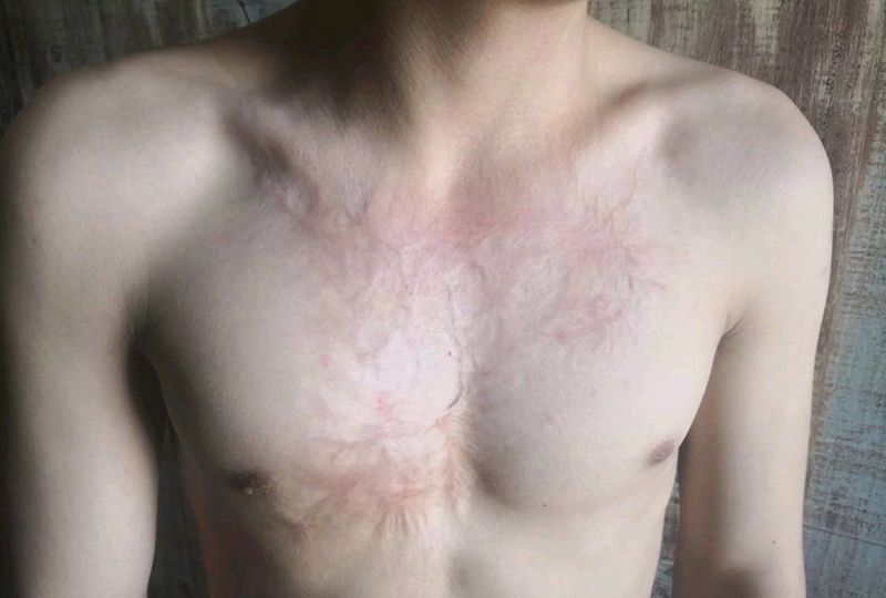 伤疤遮盖纹身图片