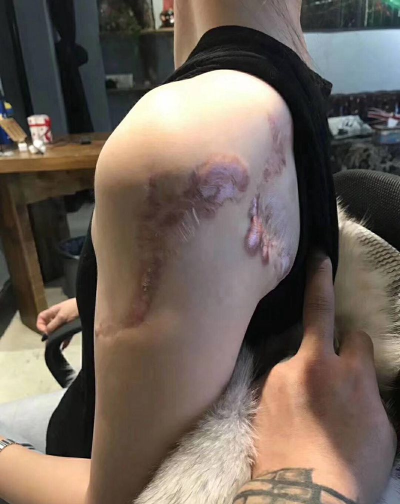 遮盖疤痕纹身图片_背部肩部欧美写实水墨遮盖疤痕纹身图案