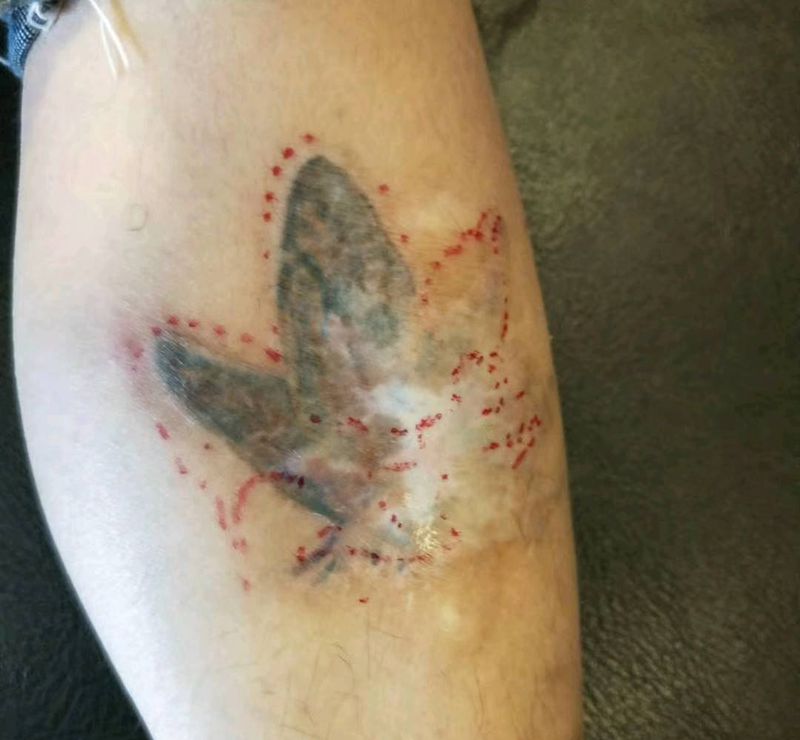 遮盖疤痕及旧图纹身图片