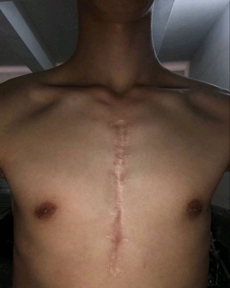 伤疤遮盖纹身图片