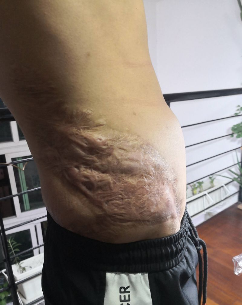 伤疤龙遮盖纹身图片_腰部新传统纹身图案