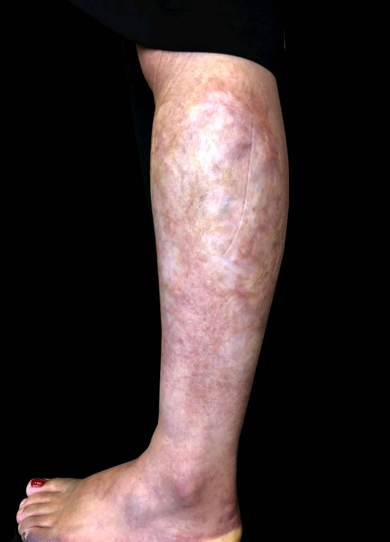 遮盖疤痕 九尾狐纹身图片_脚部腿部新传统遮盖疤痕烫伤疤九尾狐纹身图案