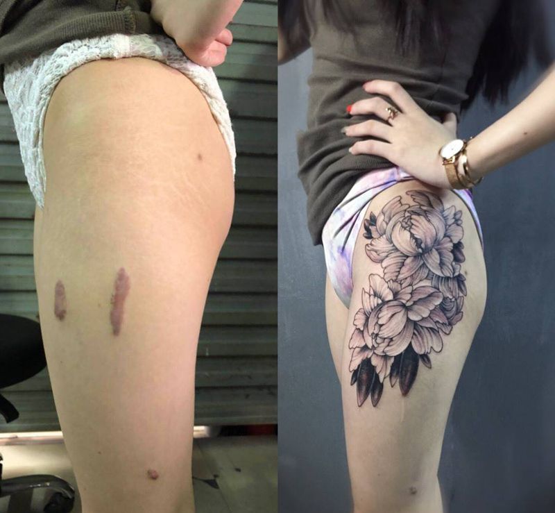 遮盖疤痕纹身图片