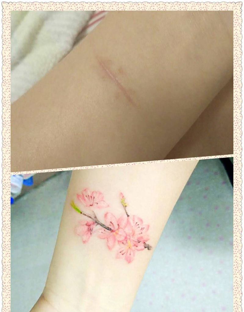 覆盖疤痕纹身图片