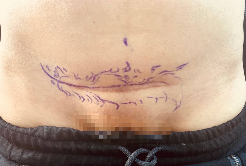 遮盖剖腹产纹身图片_腹部纹身图案