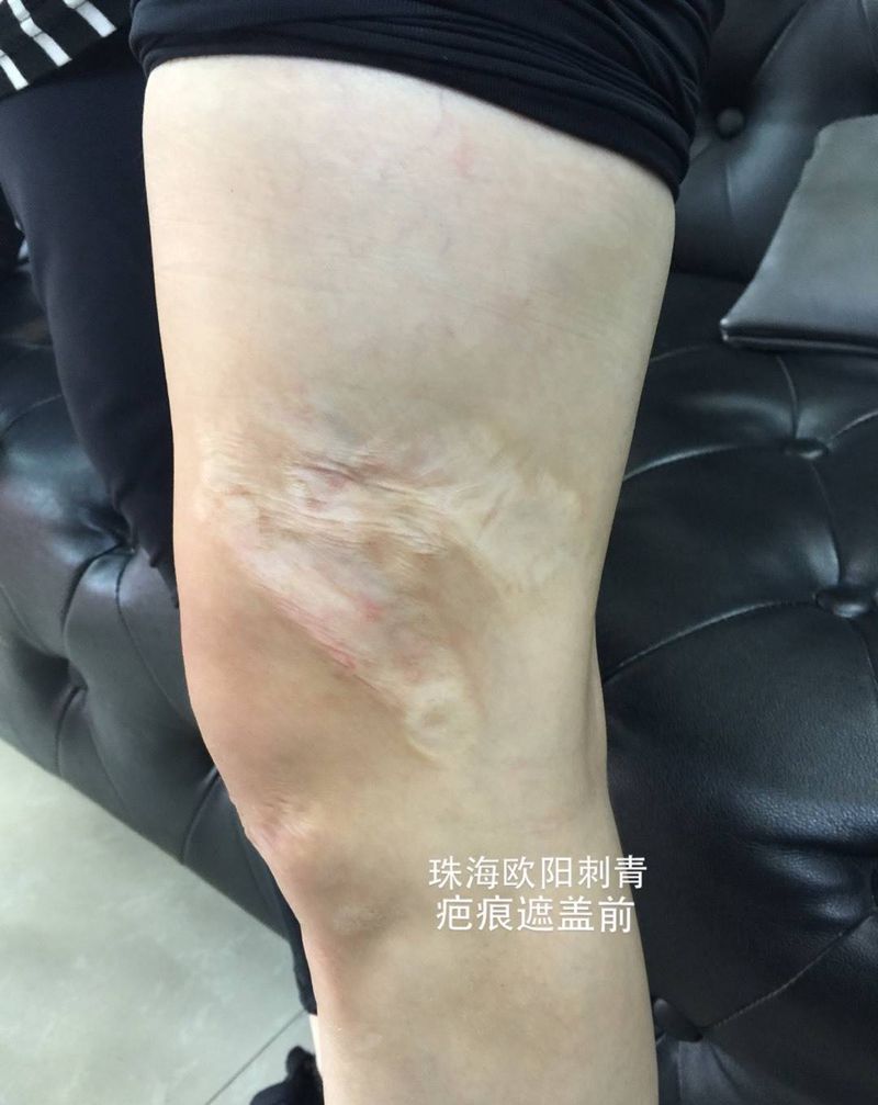 疤痕遮盖纹身图片