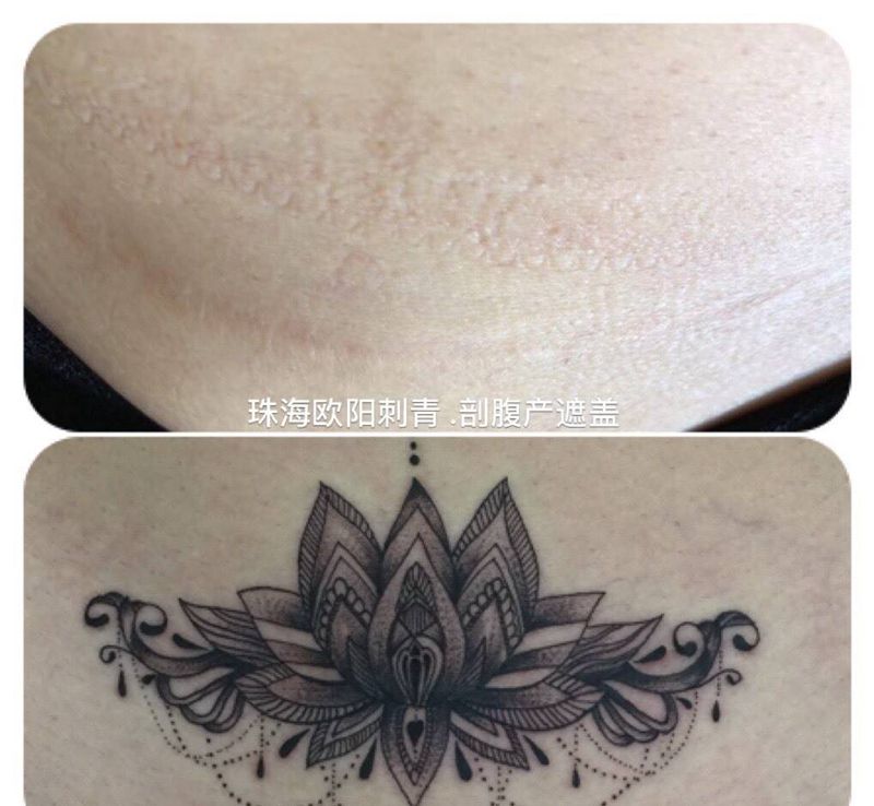 剖腹产疤痕遮盖纹身图片