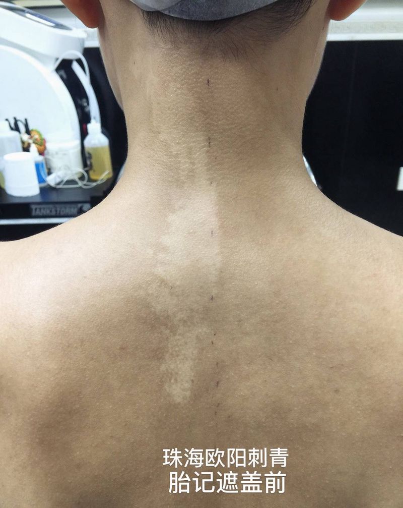 胎记遮盖纹身图片