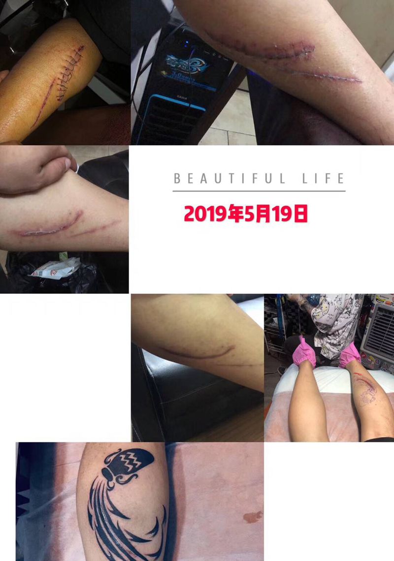 有爱记录由受伤到纹身蜕变纹身图片_腿部纹身图案