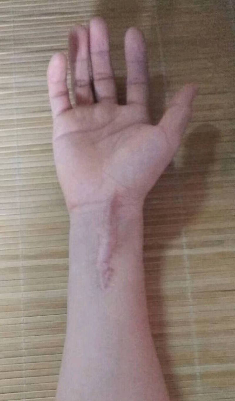 疤痕遮盖纹身图片_水彩纹身图案