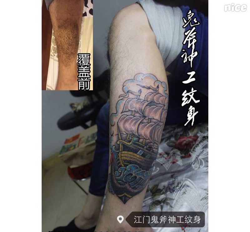 胎记覆盖纹身图片