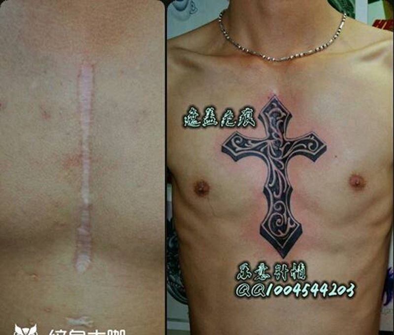 遮盖疤痕纹身图片