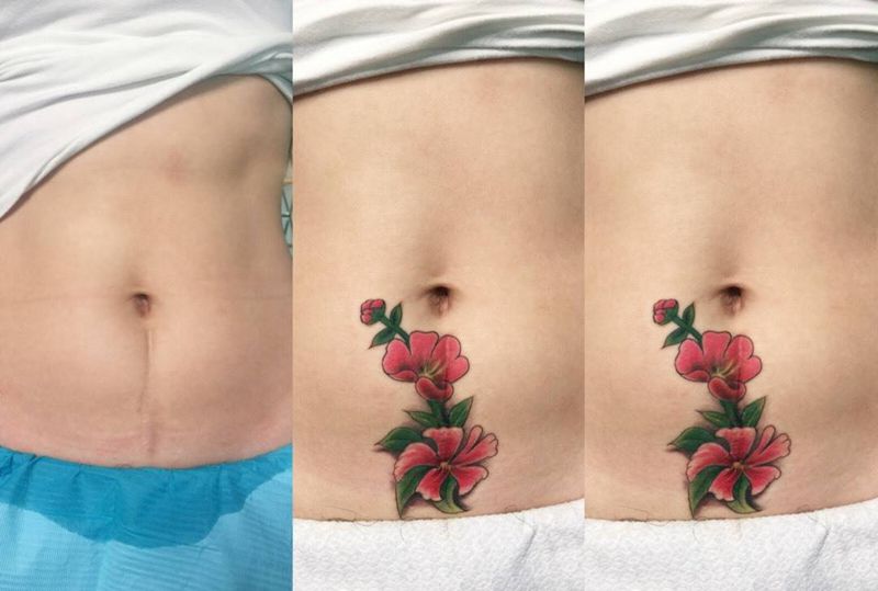 剖腹产疤痕遮盖纹身图片
