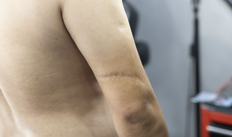 鲤鱼纹身图片_手臂纹身图案