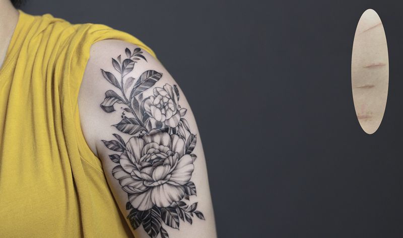 素花覆盖疤痕纹身图片_手臂手部点刺水墨素花疤痕覆盖纹身图案