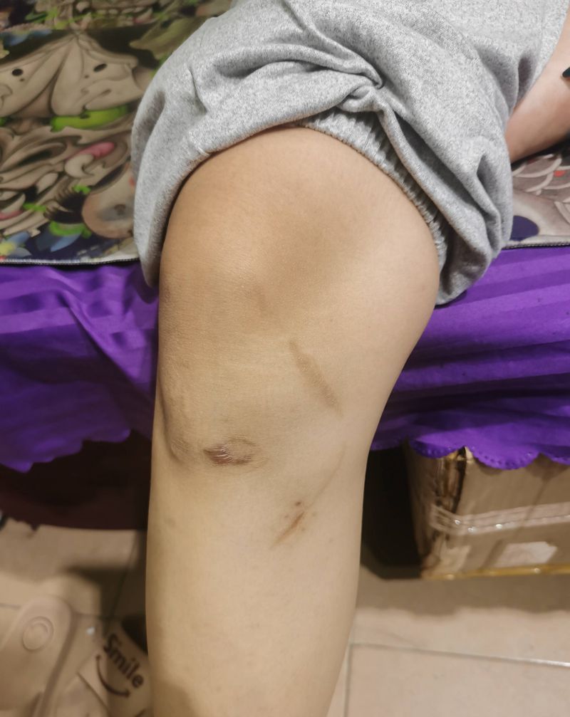 遮盖疤痕纹身图片_脚部腿部纹身图案