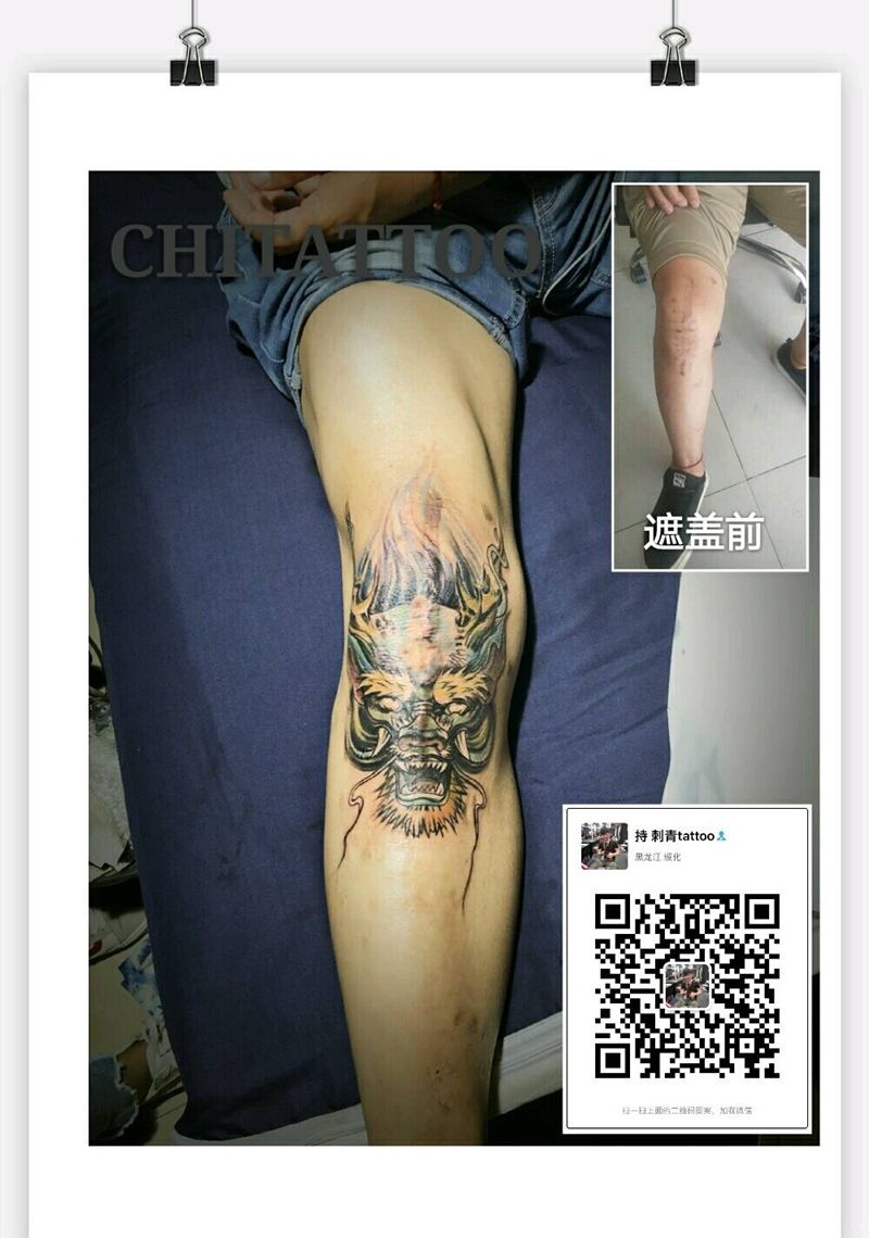 手术疤痕遮盖！纹身图片