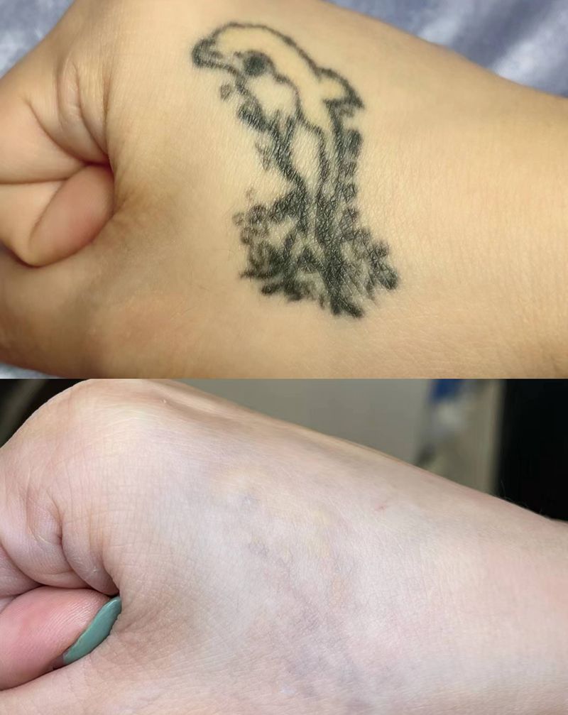 皮秒纹身图片_图腾纹身图案