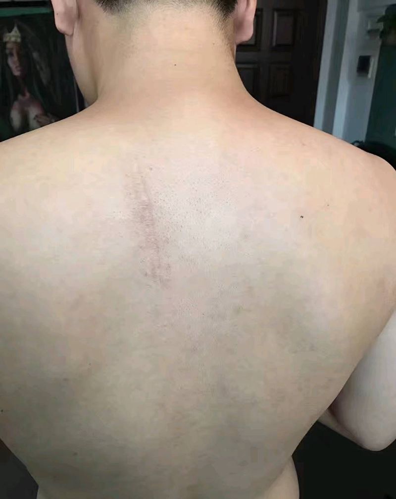 盖疤痕纹身图片_背部写实原创成品纹身图案