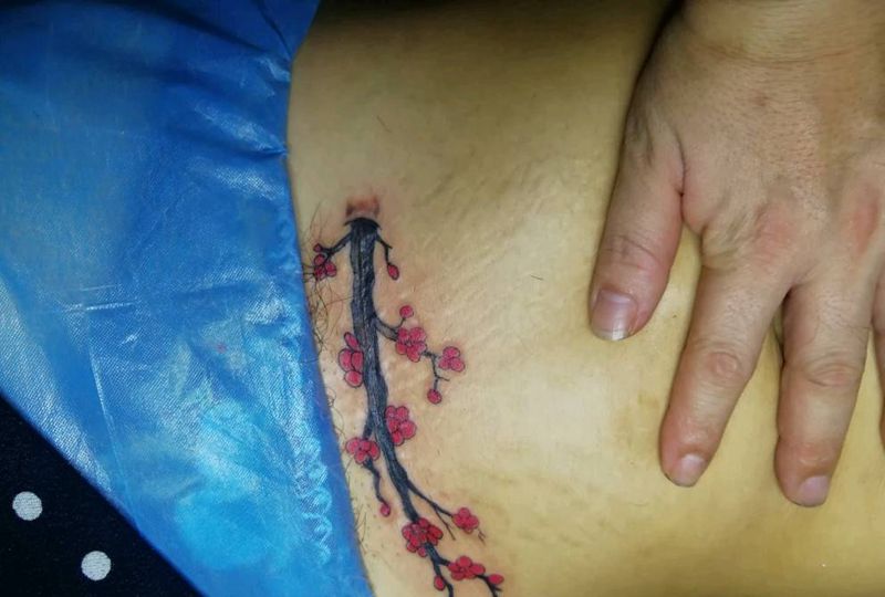 女生剖腹产遮盖纹身图片