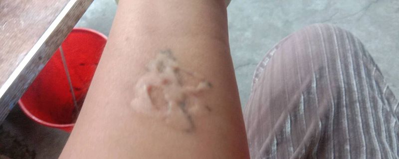 疤痕遮盖作品纹身图片_手部遮盖纹身图案