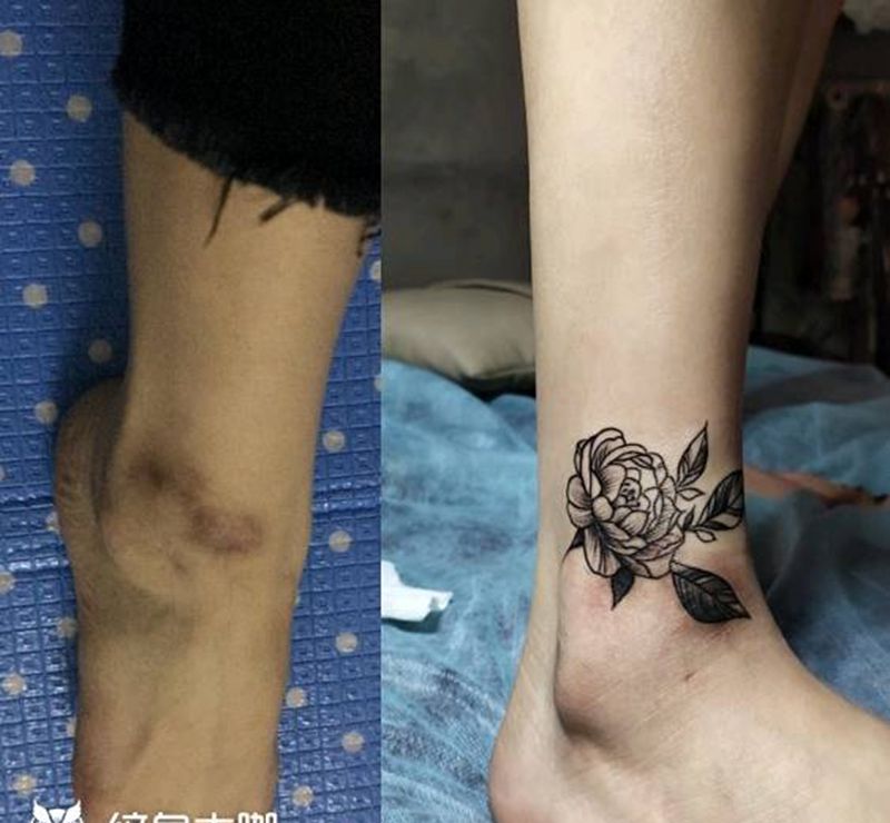 疤痕遮盖纹身图片_腿部花纹身图案