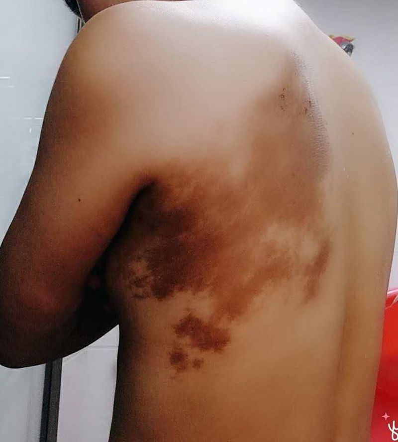 胎记遮盖纹身图片_腰部背部新传统纹身图案