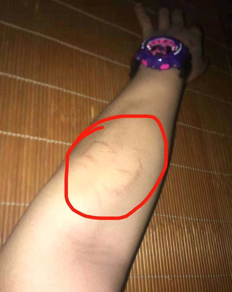 盖个疤纹身图片