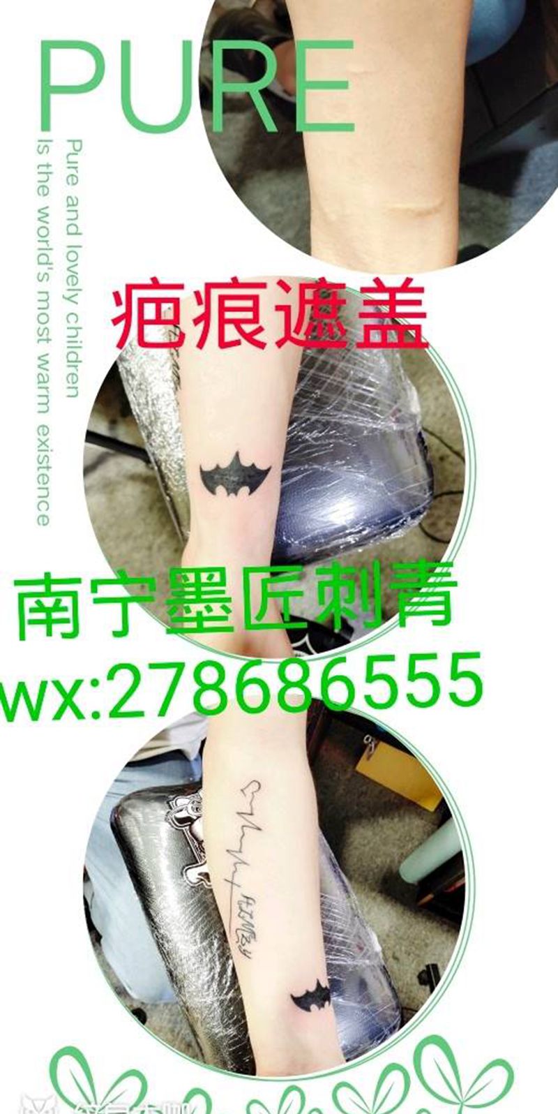 疤痕遮盖纹身图片_手部纹身图案