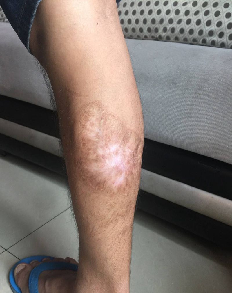 （遮盖）鱼纹身图片