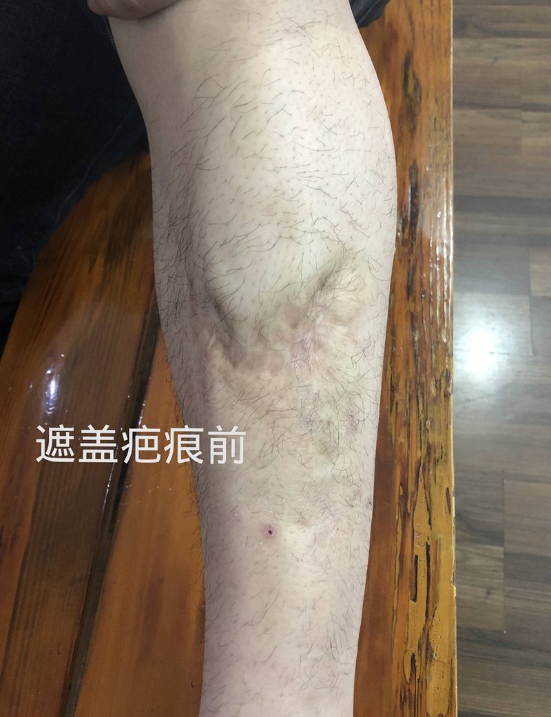 遮盖疤痕纹身图片_腿部纹身图案