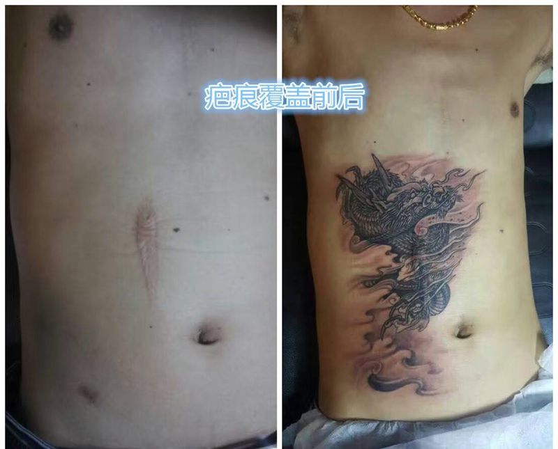 疤痕覆盖纹身图片