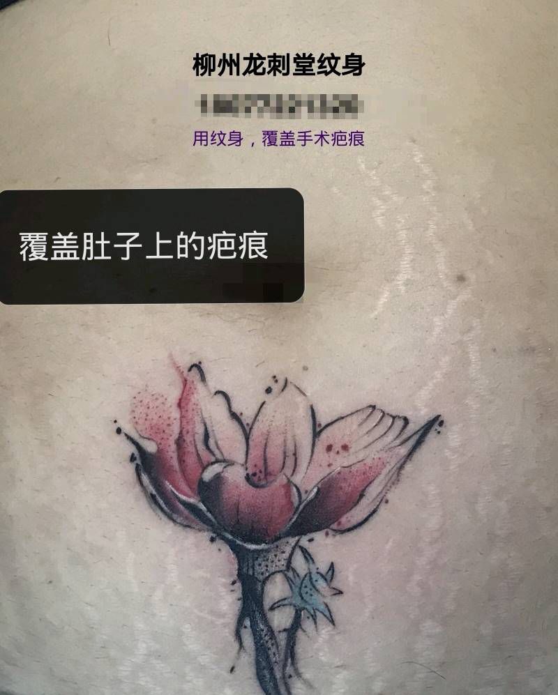 覆盖疤痕效果作品纹身图片_腹部新传统植物花纹身图案